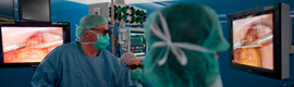 El Hospital Clínic de Barcelona usa laparoscopia en 3D para reducir riesgos y tiempo en cirugías