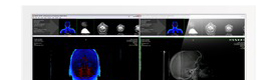 NEC Features New Large Format LCD Display with DICOM Imaging for Surgical Applications