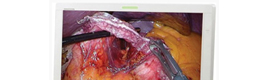 ستكشف سوني النقاب عن أحدث حلولها الطبية 3D و OLED في ميديكا 2012
