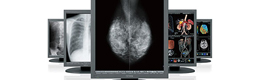 JVC Kenwood annuncia l'acquisizione della divisione Medical Imaging Displays di Totoku