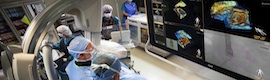 米国FDAは、心臓手術のためのフィリップスエコーナビゲーターを青信号にします