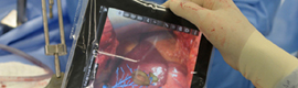 An augmented reality app for tablet helps surgeons in liver operations