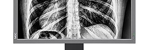 NEC MD212G: pantalla en escala de grises para diagnósticos médicos
