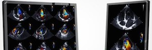 NEC MDC212C2: screen of 2 Megapixels for medical diagnostic imaging