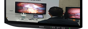 Sony LMD-X550MT y LMD-X310MT: monitores quirúrgicos con tecnologías 4K y 3D