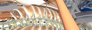 萨拉曼卡大学开发了一个脊柱侧弯手术虚拟模拟器