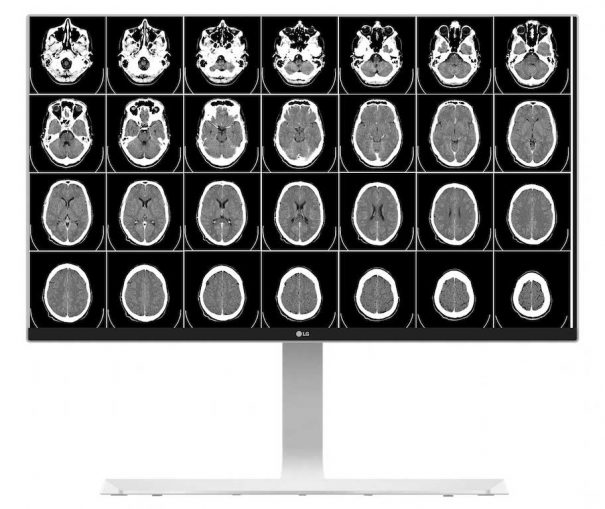 LG monitor 4k sanidad