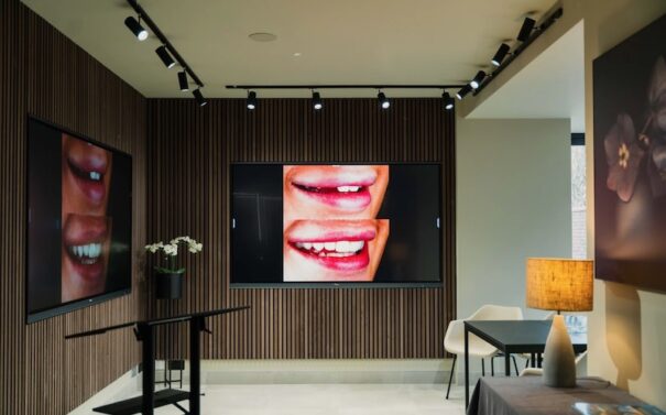 Lodge Dental Arec AVIT Vision