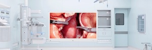 LG mejora el trabajo en entornos médicos con un nuevo monitor quirúrgico 4K